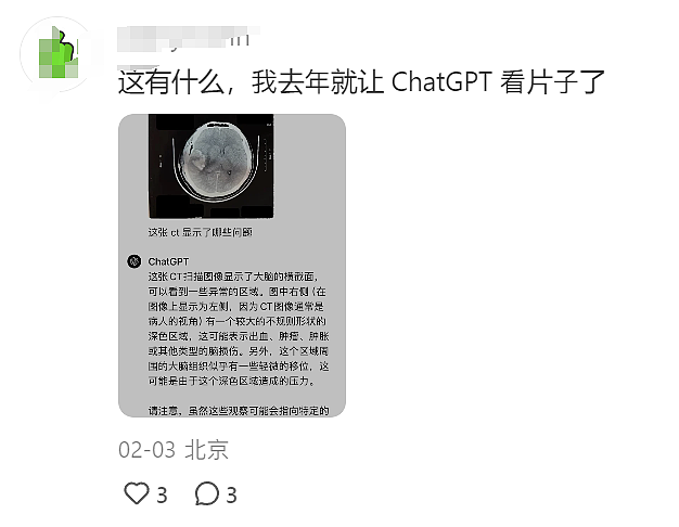 新西兰脑癌患者用DeepSeek给自己看病，结果“完胜GP”！又有行业天塌了……（组图） - 5