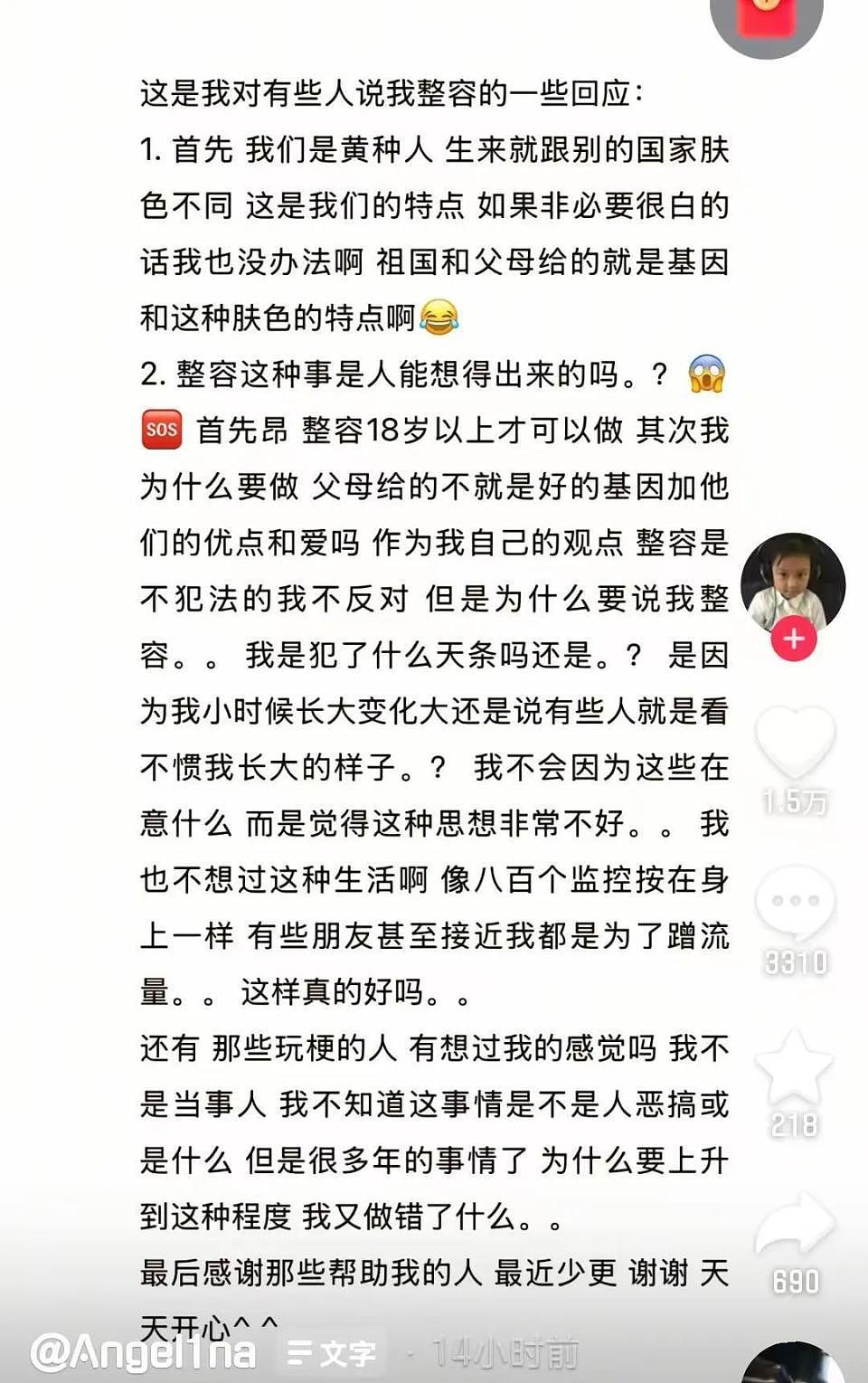 《爸爸去哪儿》孩子现状：石头变帅去艺考，森碟矫正下巴，甜馨否认整容（组图） - 43