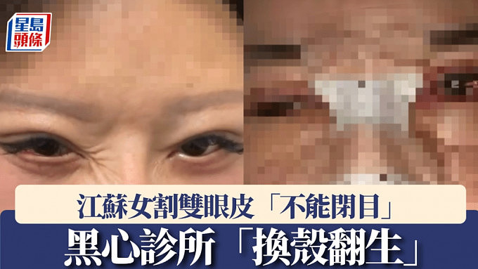 整容致10级伤残！江苏女割双眼皮“不能闭目”， 黑心诊所“换招牌”继续经营（组图） - 1