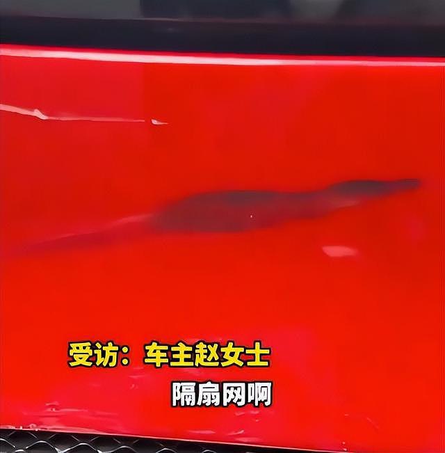 新能源车主被充电枪“打脸”缝8针！小鹏汽车：属实，已对车主提供必要关怀（组图） - 8