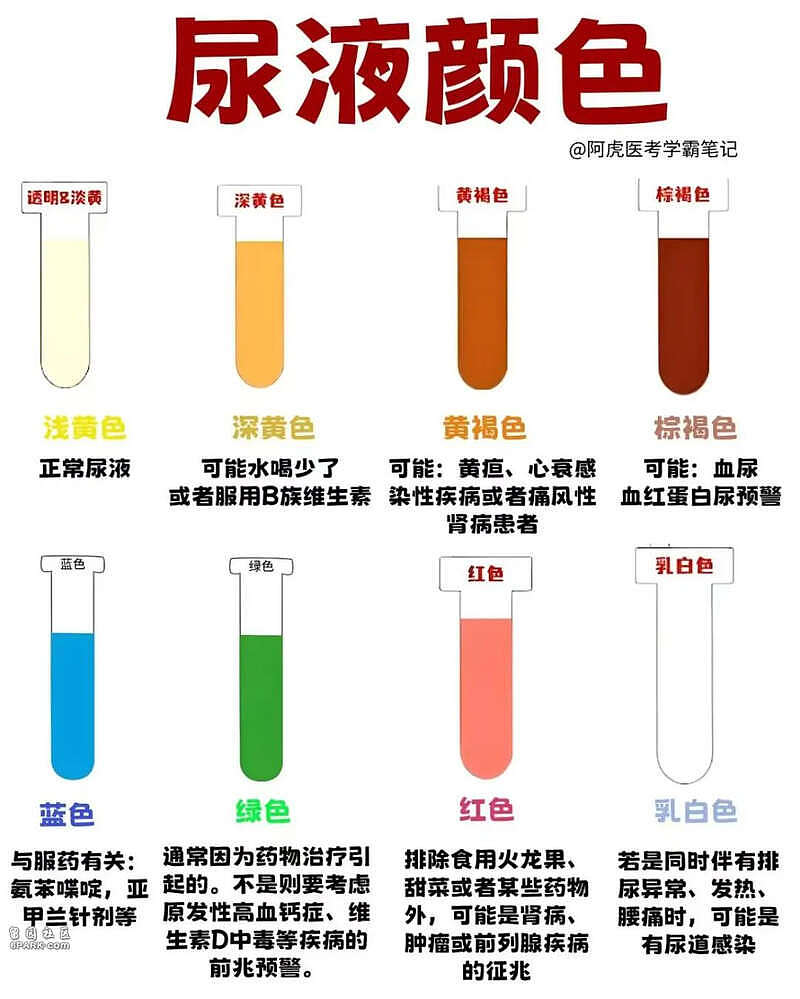 早晨第一泡尿，可能是身体在呼救！这些信号别忽略（组图） - 3