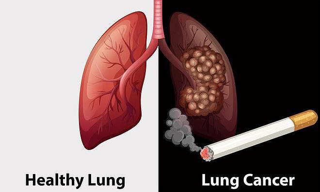 【健康】吸一根烟减去多少寿命？最新研究来了，烟民看完之后沉默不语（组图） - 5