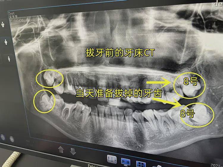 34岁女子拔牙后跳楼坠亡：生前朋友圈流出，单亲妈妈，细节披露（组图） - 3