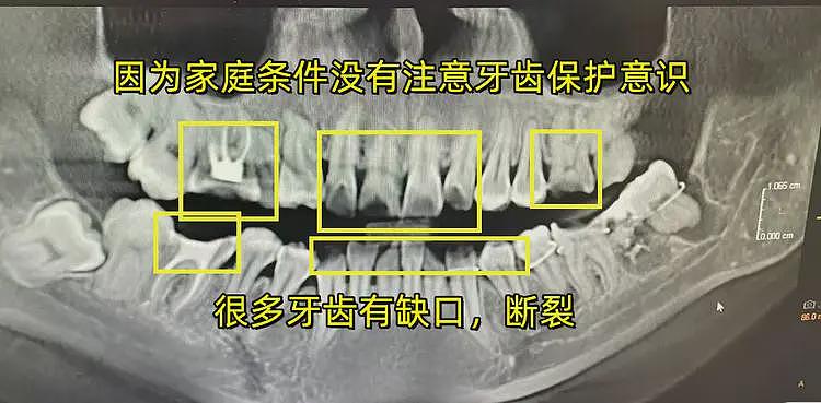 34岁女子拔牙后跳楼坠亡：生前朋友圈流出，单亲妈妈，细节披露（组图） - 13