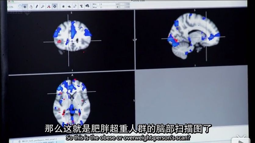 再次颠覆认知！减肥失败不是因为意志力？胖子其实更不容易饿？BBC纪录片让人大开眼界（组图） - 23