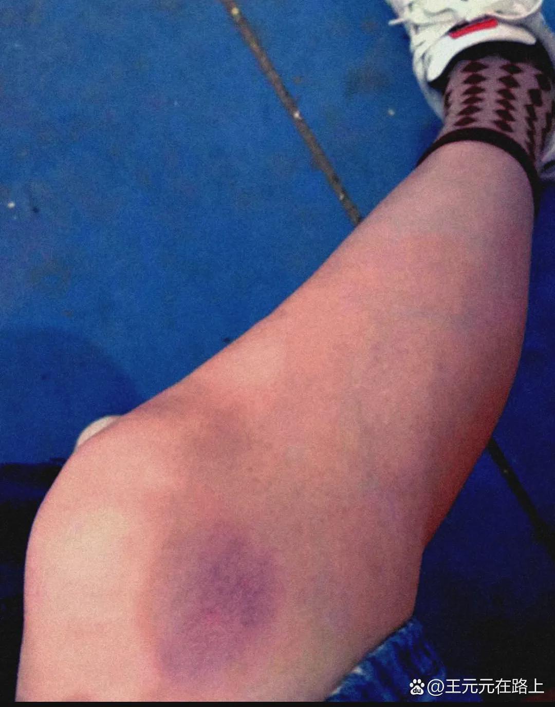 热搜上“郑州女子被企业家老公逼喝尿、吃痰”事件：这不是家暴，这是奴性虐待（组图） - 5