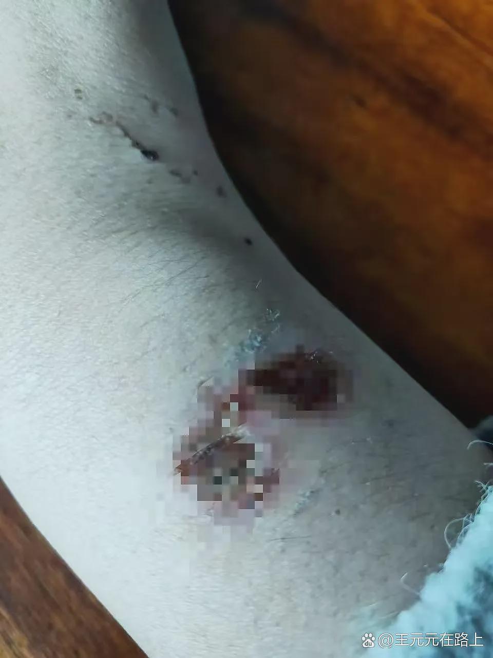 热搜上“郑州女子被企业家老公逼喝尿、吃痰”事件：这不是家暴，这是奴性虐待（组图） - 3