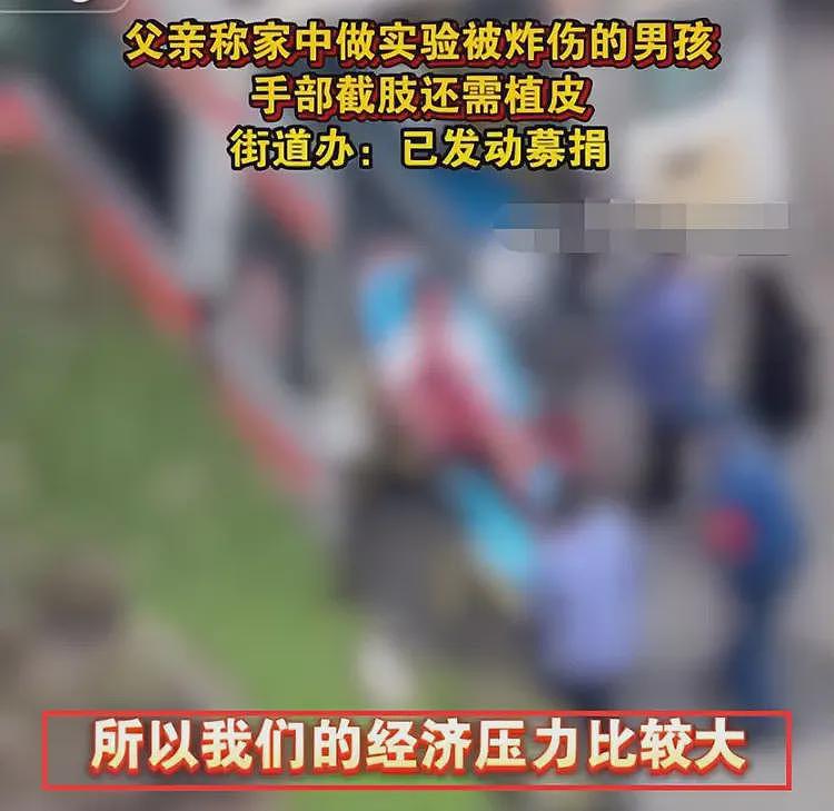 广东男孩实验爆炸后续：将截肢右眼全瞎，住房4万1平经济压力还大（组图） - 8