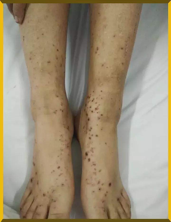 “你这么不听道理，一定是辣条吃多了吧？！”毁掉80、90后的软毒品只要五毛钱（组图） - 29