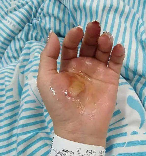 女子家中洗澡疑热水器漏电被电击,差一点救不回来(组图) - 2