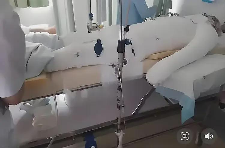 90%烧伤武大生277天后首度发声：父母为我割皮借钱，绝不原谅室友（组图） - 7