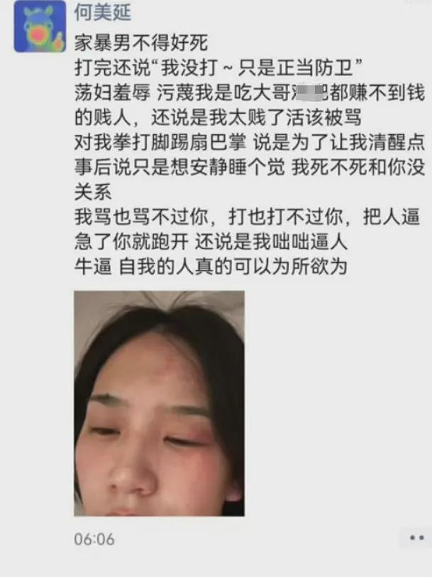 娱乐圈“模范夫妻”人设崩塌，家暴、荡妇羞辱、孕期聊骚，占全了（组图） - 3