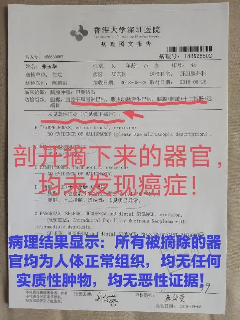 七旬老人被当“癌症患者“切除5个器官，数月后离世（组图） - 7
