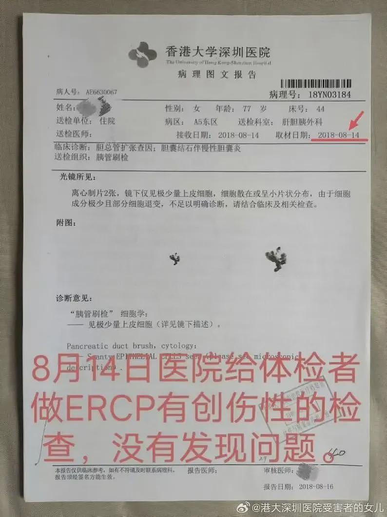 七旬老人被当“癌症患者“切除5个器官，数月后离世（组图） - 3