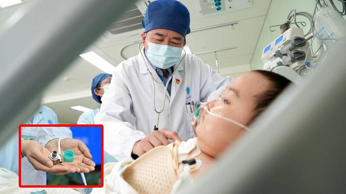 全球首例！华研最轻最细人工心，武汉植入7岁病患（组图） - 1