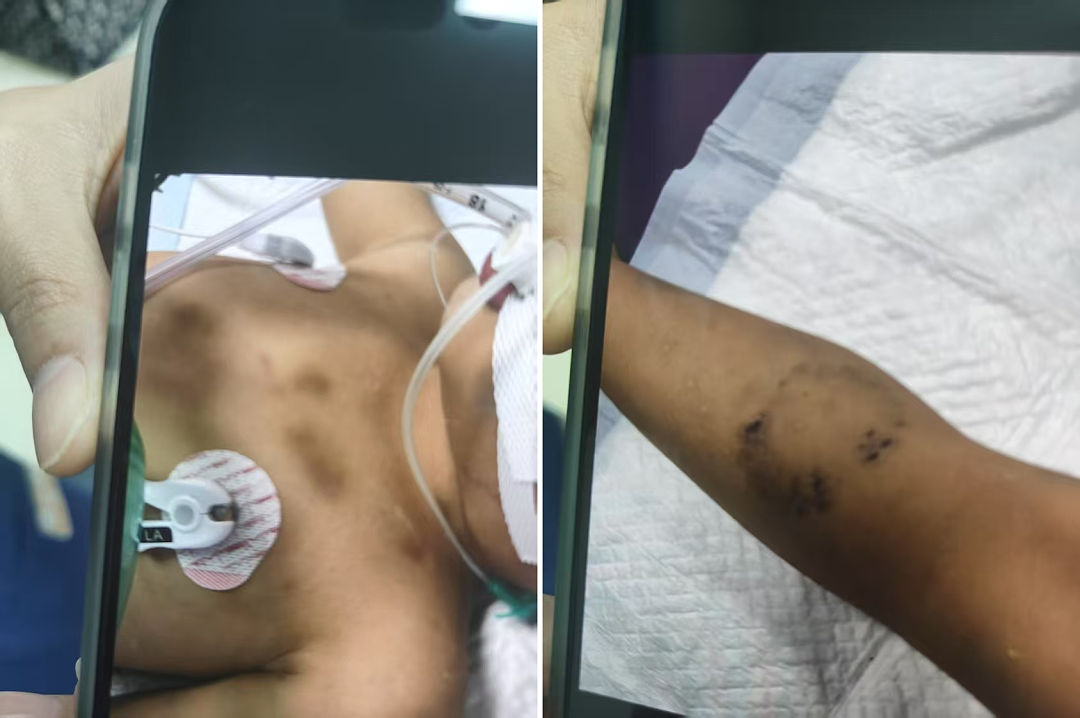 “3岁男童被生父女友虐待后死亡”案开庭！生母：赶到ICU时孩子眼角有泪，曾饿到要饭吃（组图） - 2