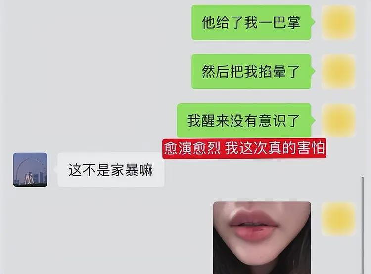 嘴巴扇流血、逼吃安眠药！中俄网红夫妻后续反转，男方真面目被扒（组图） - 7