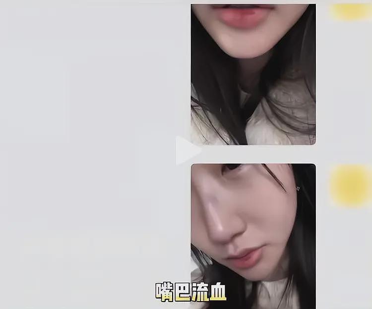 嘴巴扇流血、逼吃安眠药！中俄网红夫妻后续反转，男方真面目被扒（组图） - 13