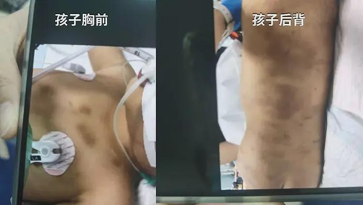 3岁男童被虐致死案生母:孩子抢救时听到妈妈来了流下眼泪(组图) - 2