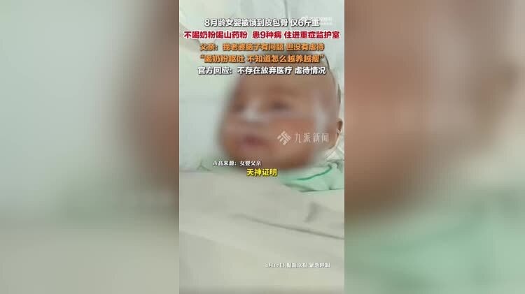 8月龄仅6斤重女婴父亲发声：不知道怎么越养越瘦（图） - 1