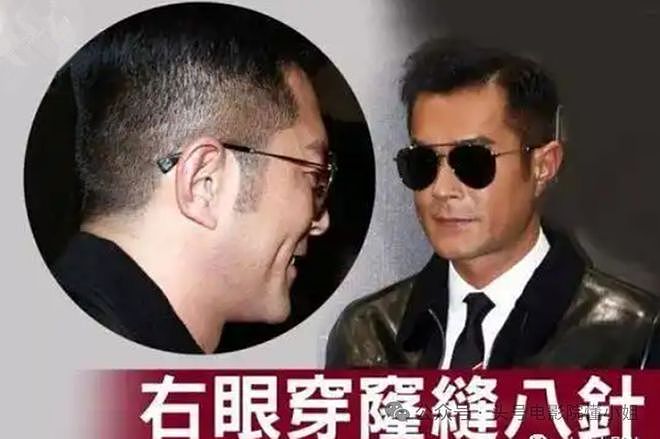 古天乐右眼恐失明，之前缝过8针！54岁未婚仍拼命，颈椎骨也换过（组图） - 4