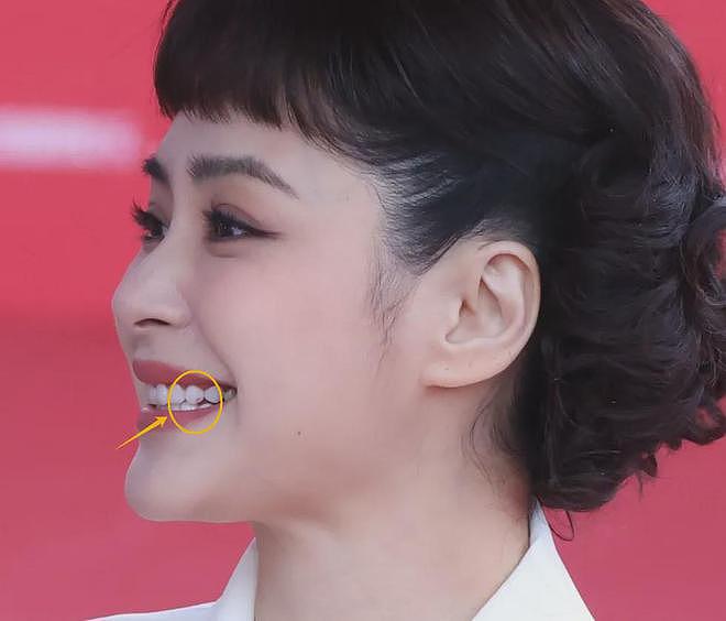 北影节开幕雨中红毯，倪妮李梦湿身显狼狈，阿娇口红沾牙太尴尬（组图） - 17