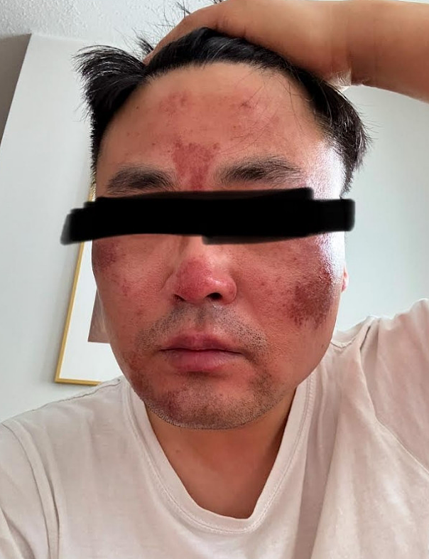 太吓人!华人父子吃麦当劳遭陌生人围堵+辣椒水袭击!全脸灼伤送医(组图) - 2