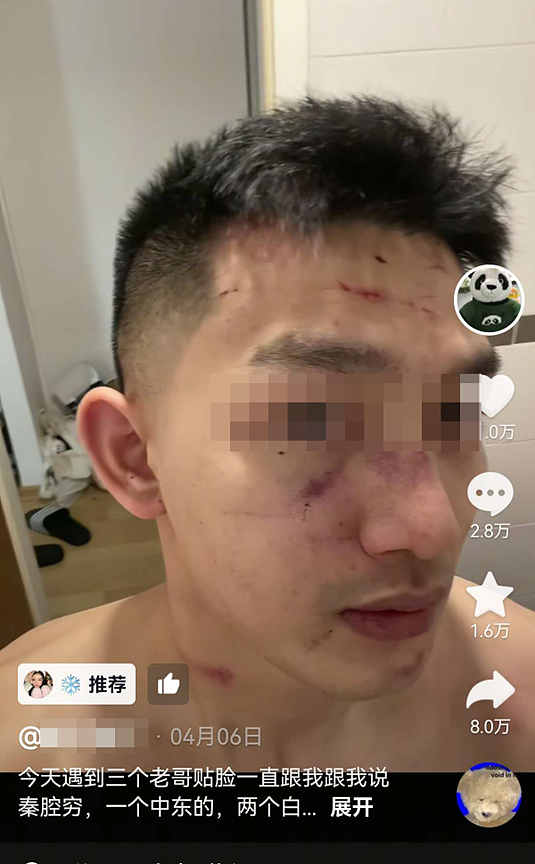 一挑三!中国留学生暴打辱华老外,周围国人冷漠旁观?(组图) - 3