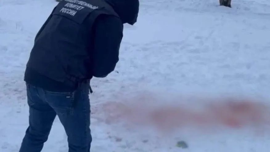 男子被恶犬咬成重伤，过于残忍的画风，甚至直接吓死了保安…（组图） - 6