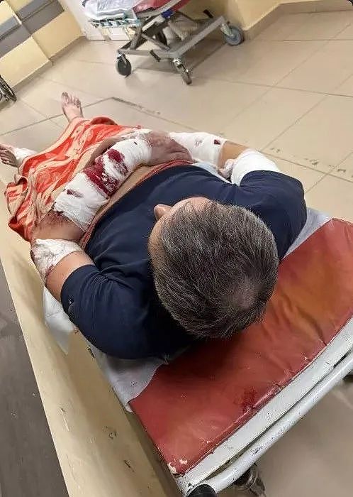 男子被恶犬咬成重伤，过于残忍的画风，甚至直接吓死了保安…（组图） - 5