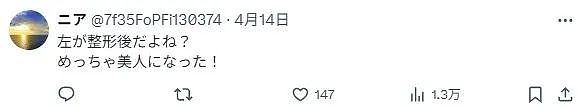 妹子想整成佐佐木希,花费上千万却被疯狂吐槽,整之前更美?(组图) - 4