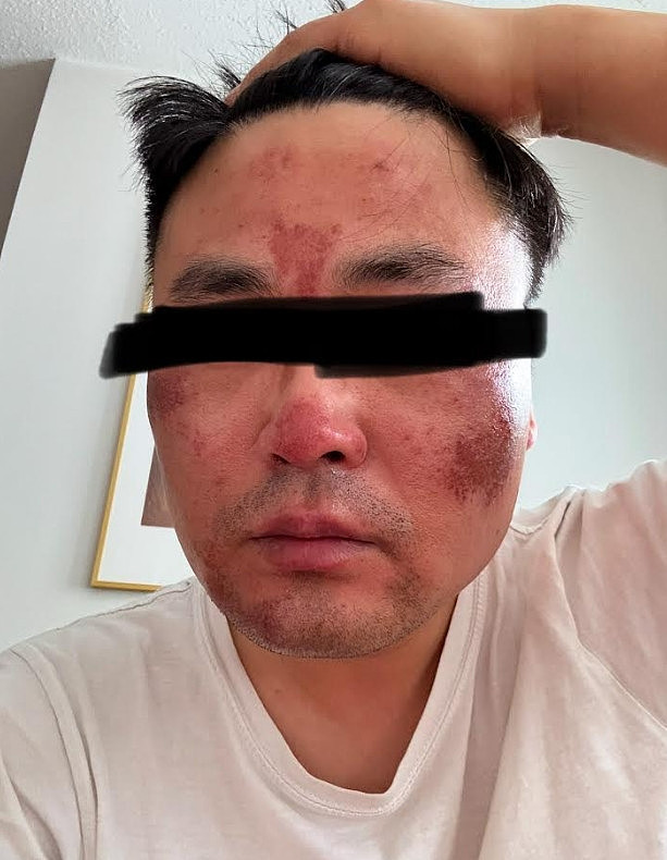 华人网友曝！带娃吃麦当劳遭女孩碰瓷，还可怕袭击...（组图） - 2