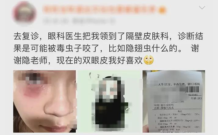 毒液堪比硫酸，一地确诊200多例！千万不要拍，有人差点毁容（组图） - 2