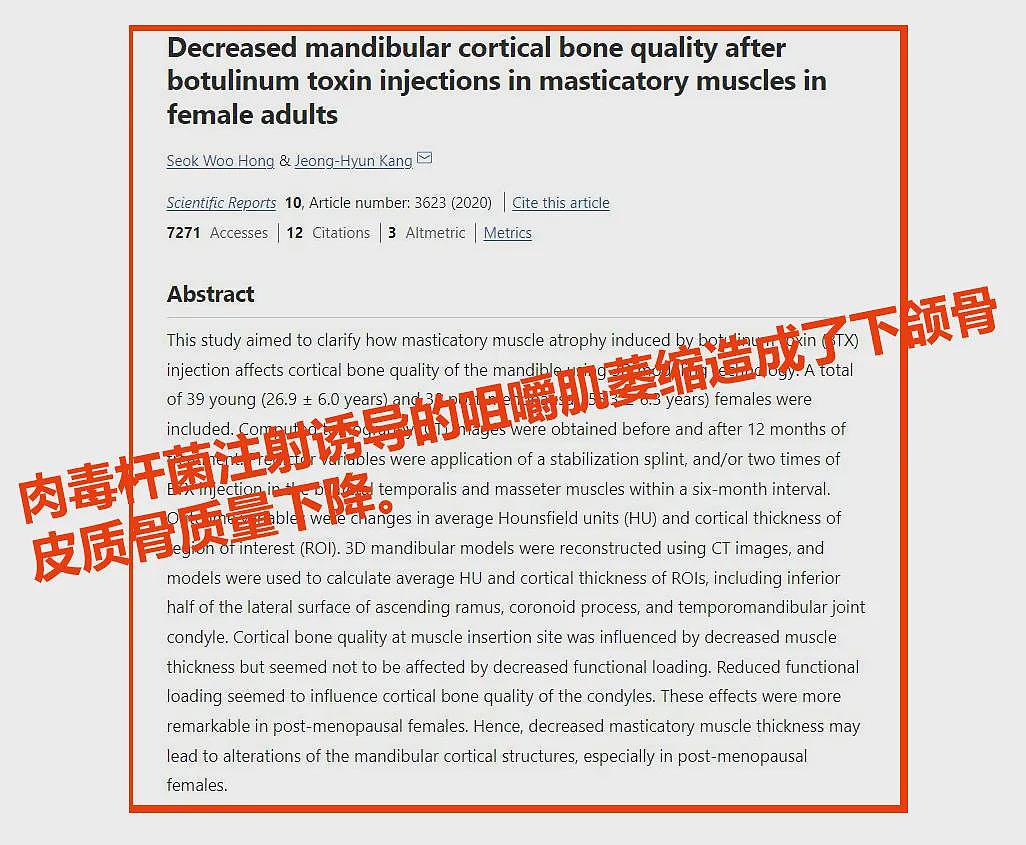 想脸不垂?先解除对“咬肌”的偏见!(组图) - 15