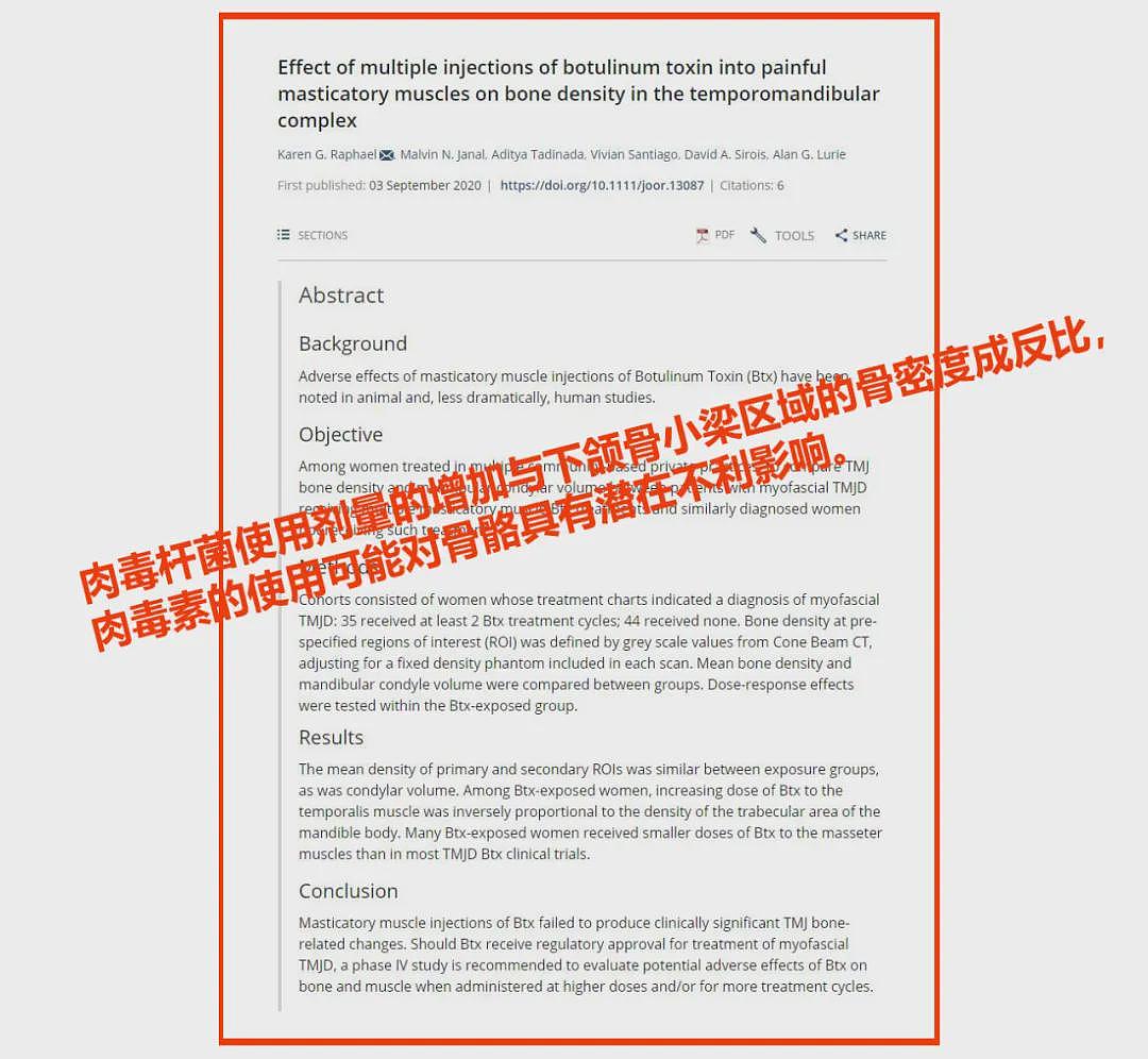 想脸不垂?先解除对“咬肌”的偏见!(组图) - 14