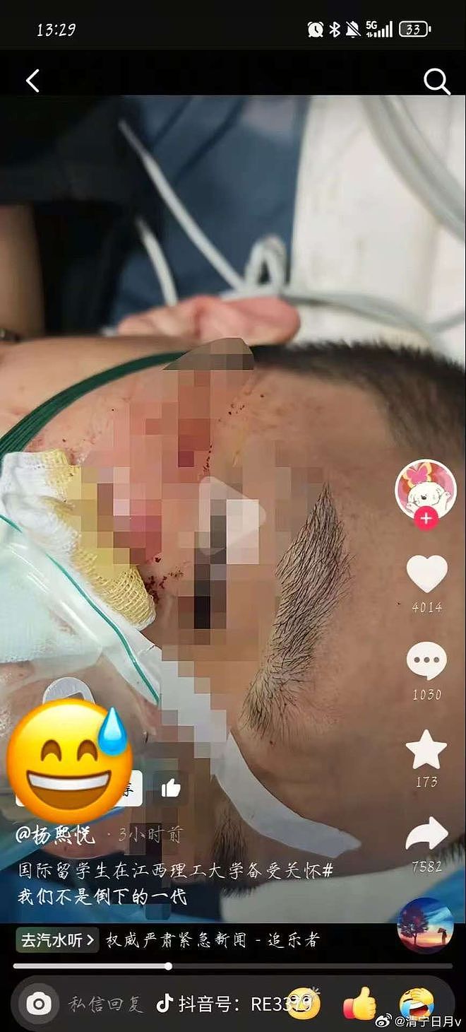 网友自曝健身时遭江西高校留学生围殴，校方休想息事宁人（组图） - 1