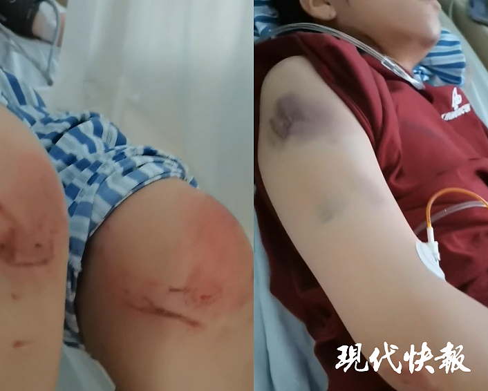 河北女子被丈夫持刀家暴后驾车逃跑，致扒车随行丈夫身亡，一审以故意杀人罪获刑11年（组图） - 2