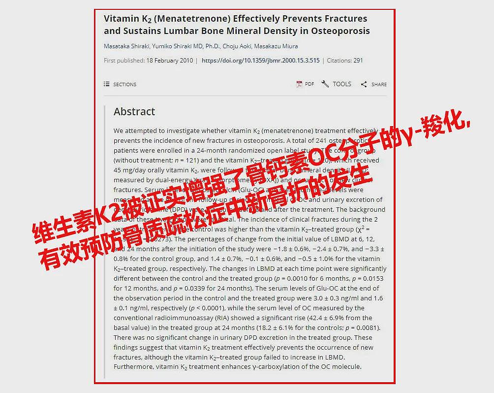 想脸不垂?先解除对“咬肌”的偏见!(组图) - 17