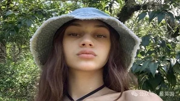 美女被医院强制打3针y苗后突发失明！全身淤黑剧烈肿胀、面目全非！医生却开始甩锅（组图） - 1