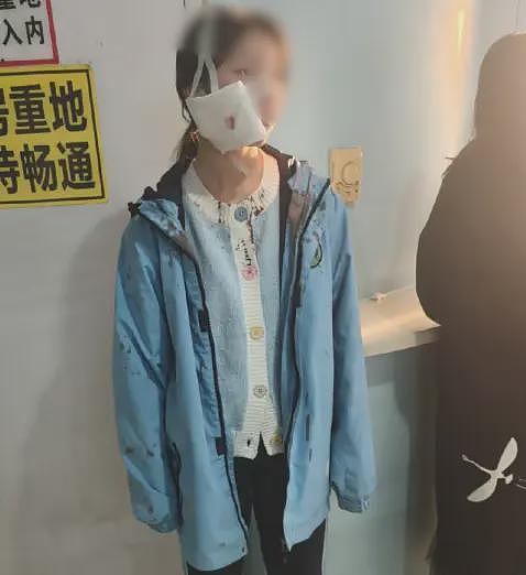网传西安一女中学生，脸部被刀砍到皮开肉绽，当地派出所：伤人者不满15岁不予立案（组图） - 2