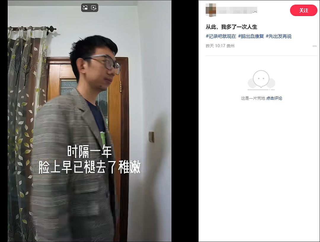 月薪3万,长期熬夜!35岁程序员脑干出血,ICU抢救28天,昏迷15天!本人发声回应(组图) - 1