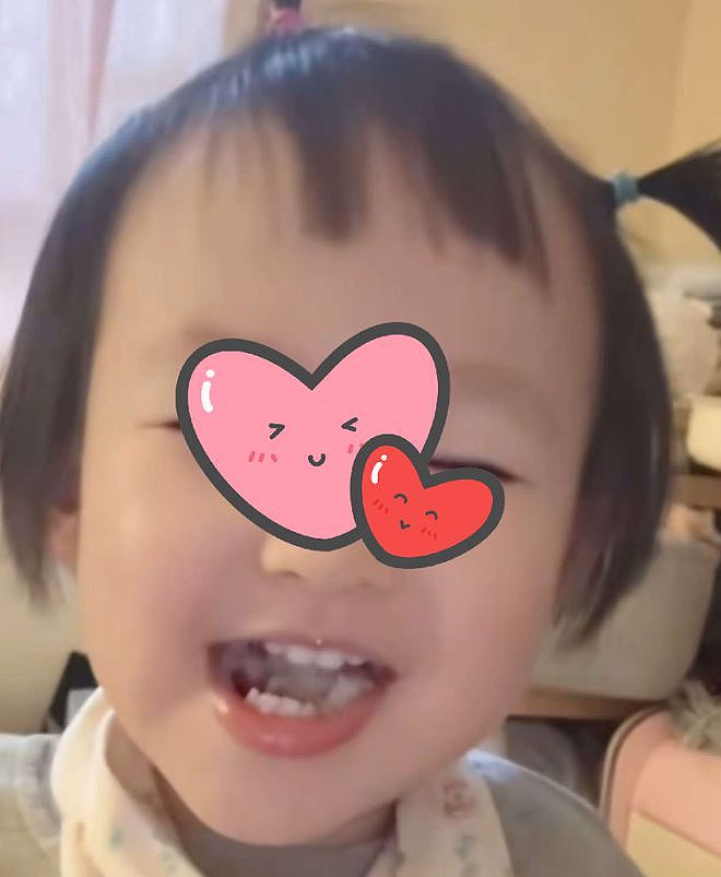 黄一鸣晒女儿近况，孩子反颌严重不见干预，跟王思聪讨钱又失败（组图） - 17