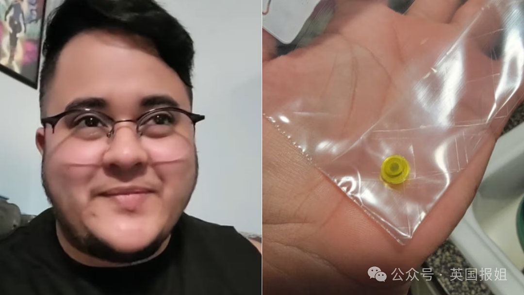 英男子左耳剧痛多年差点失聪,睡一觉竟抠出“包浆”玩具零件!医生:藏了20几年(组图) - 14