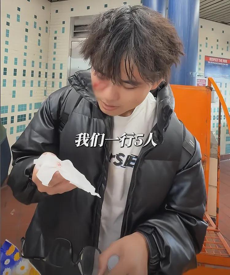 千万网红去美国“僵尸城”，因一举动被当街殴打，报警反被割韭菜（视频/组图） - 19