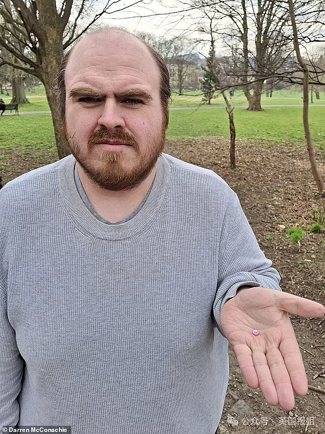 英男子左耳剧痛多年差点失聪,睡一觉竟抠出“包浆”玩具零件!医生:藏了20几年(组图) - 5
