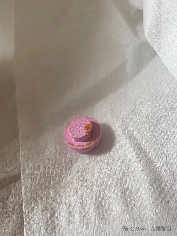 英男子左耳剧痛多年差点失聪,睡一觉竟抠出“包浆”玩具零件!医生:藏了20几年(组图) - 6