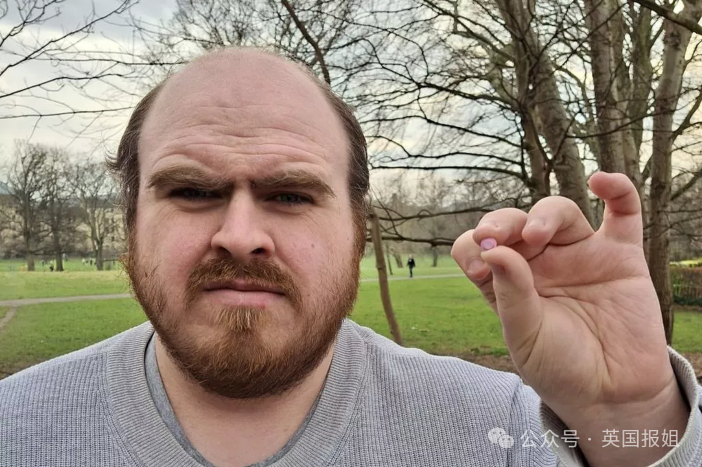 英男子左耳剧痛多年差点失聪,睡一觉竟抠出“包浆”玩具零件!医生:藏了20几年(组图) - 7