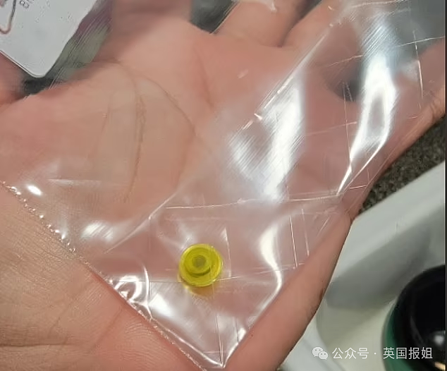 英男子左耳剧痛多年差点失聪,睡一觉竟抠出“包浆”玩具零件!医生:藏了20几年(组图) - 11