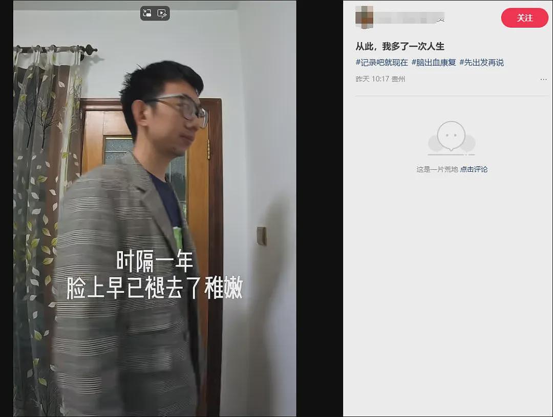 35岁程序员脑干出血，ICU抢救28天，长期有这坏习惯！还有大厂员工公司猝死，千万警惕（组图） - 2