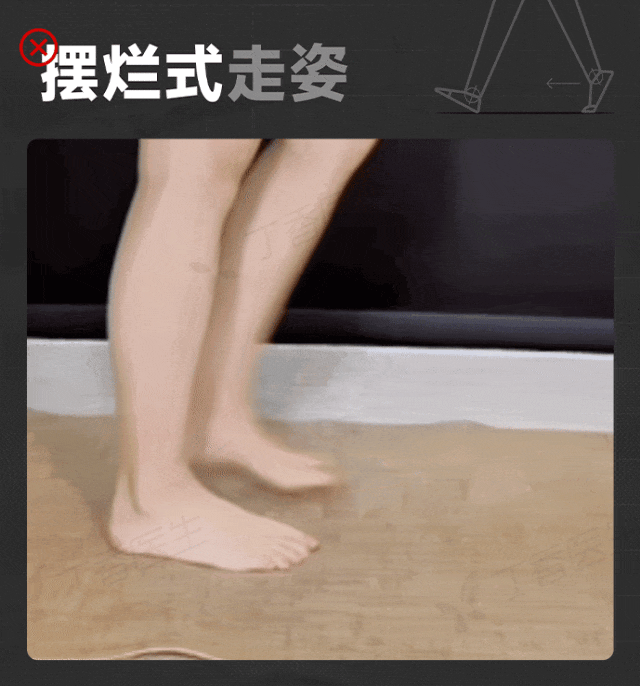 加速“身体报废”的小动作,你可能每天重复几千次(组图) - 6